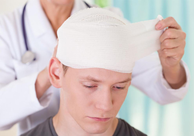 Sơ cứu nhanh chóng khi bị đập đầu xuống đất, tránh biến chứng chấn thương sọ não cực nguy hiểm - Ảnh 1. c1 15252395800081109310428 Hướng dẫn sơ cứu nhanh chóng khi bị đập đầu xuống đất, tránh biến chứng chấn thương sọ não cực nguy hiểm
